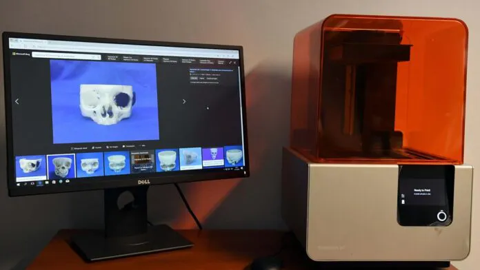 unaj-guias-quirurgicas-3d-696x392